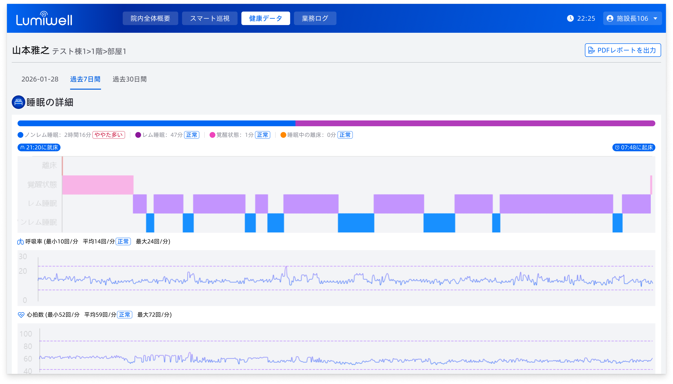 バイタル生体データプレビュー